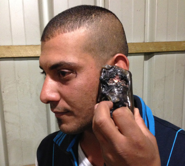 فيديو: إصابة الشاب رائف أبو معمر من اللد اثر انفجار هاتفه الخليوي 